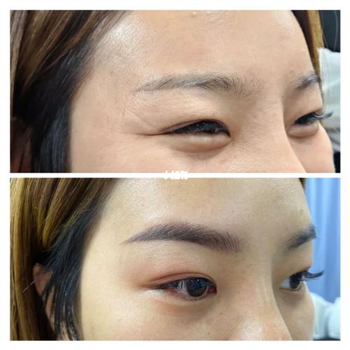 第三张图是刚做完即刻,这才应该是野生眉一个月后的样子,看到薯友们