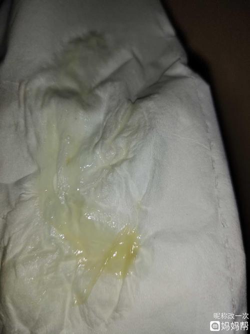 这是什么是刚排卵么
