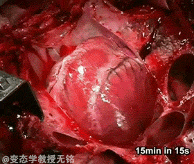 【潍坊论坛猎奇】心脏停跳全过程