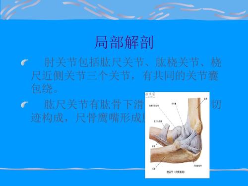 尺骨鹰嘴滑膜囊炎