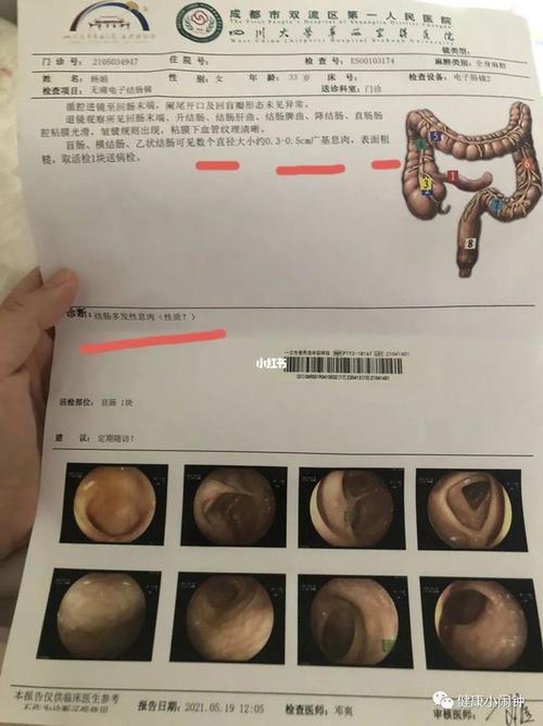 并伴有便血,脓血便等问题,肛管癌会出现疼痛和出血的情况,肿物呈菜花