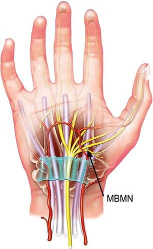 这主要跟手腕内部的构造有关系,相比于其他关节,  手腕内部比较多是