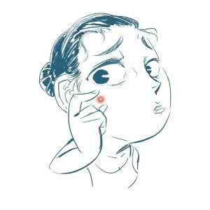 脸上长痘痘可以挤痘痘吗?