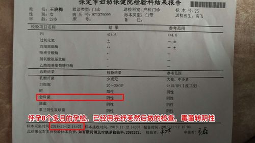 外阴阴道假丝酵母菌病(霉菌性阴道炎)