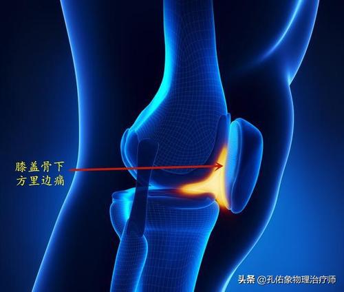 膝盖骨下方里边痛,是什么问题?