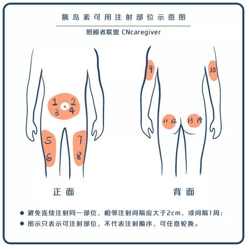 糖尿病患者使用和储存胰岛素,首先要知道这些