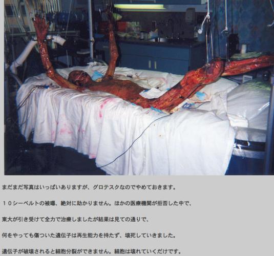 的日本论坛网址看) (上图存疑,有评论指出上面这张图片并非大内久本人