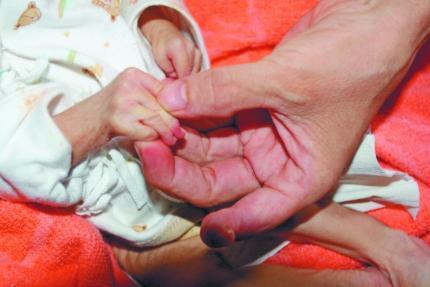 足月小样儿的诊断