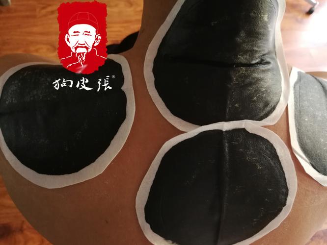 颈肩酸痛能贴狗皮张膏药吗