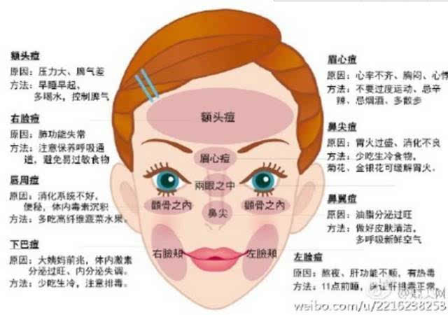 脸上长痘痘什么原因? 里面就有什么病!