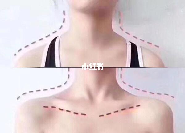 【什么样的肩膀好看】:两个标准_肩颈_颈椎_直角肩_生活记录_日常片段