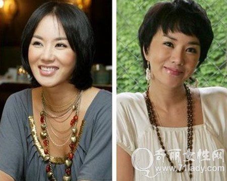 严正花整容太厉害 严正花整容前后对比照片(2)