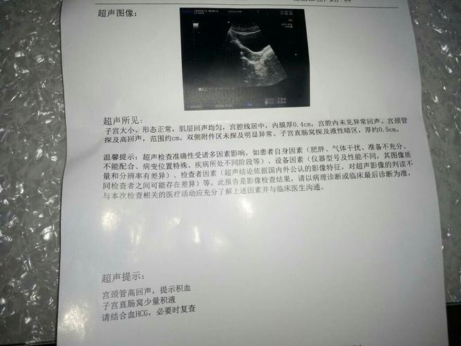 宫外孕还是自然流产了