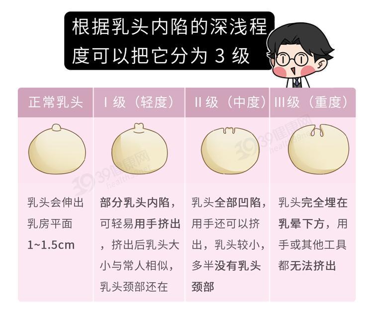乳头内陷该怎么办
