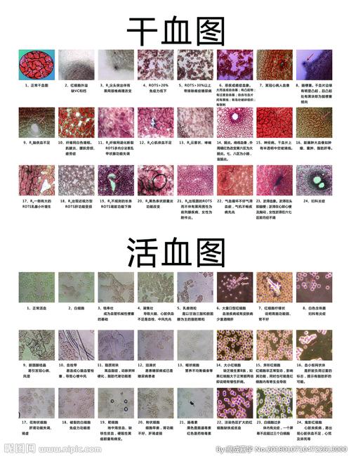 干血图和活血图图片