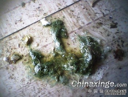 白色念珠菌感染治疗实录(图)