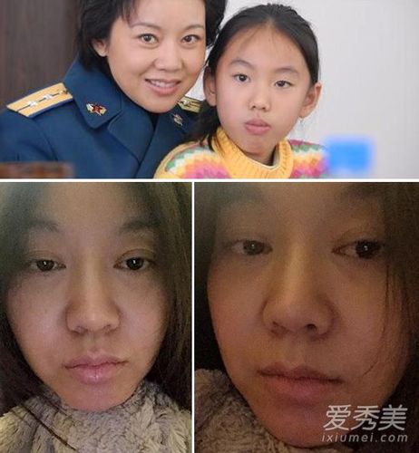 上海频道 > 正文   原标题:张雨绮闫妮李玟刘涛 割双眼皮后才是真女神