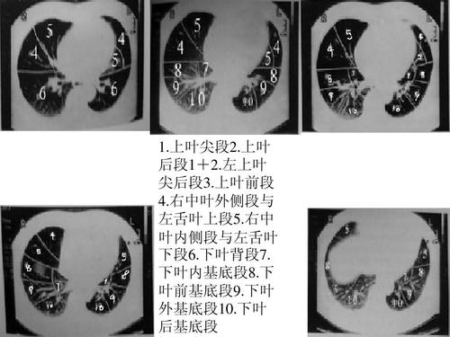 肺段的划分ppt