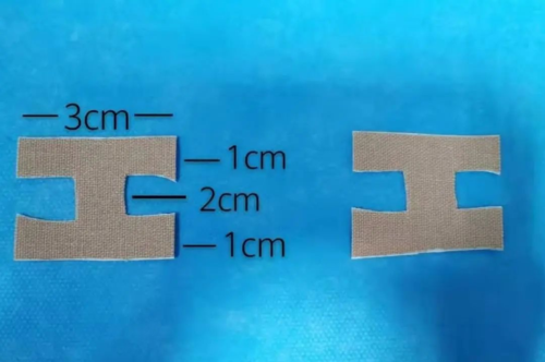 日常如何维护胃管 妥善固定 (1)胃管固定:取4厘米"3m"胶布裁剪成"工