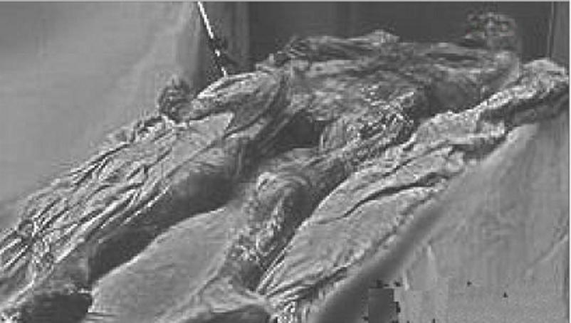 趣谈清朝皇帝,被砒霜毒死的光绪皇帝!