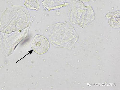 移行上皮细胞(表层)
