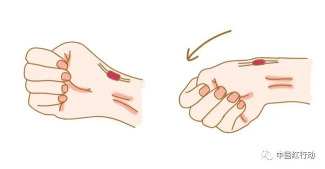 1个动作判断手腕腱鞘炎!4个方法摆脱疼痛~|关节|关节