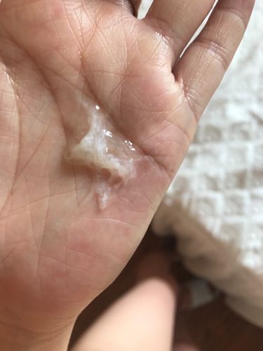 白带透明有杂质的感觉