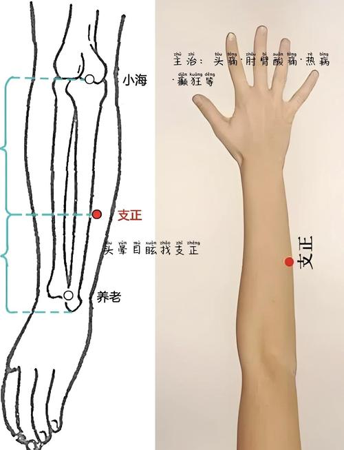 支正穴位置:它位于前臂面尺侧,具体在阳谷与小海的连