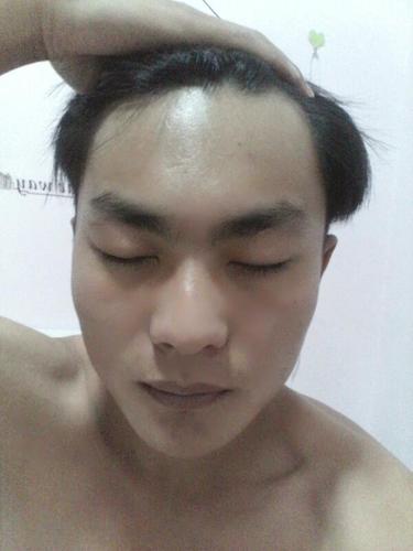 请问大神么我这发际线算高么?还是正常?求解谢谢谢谢.