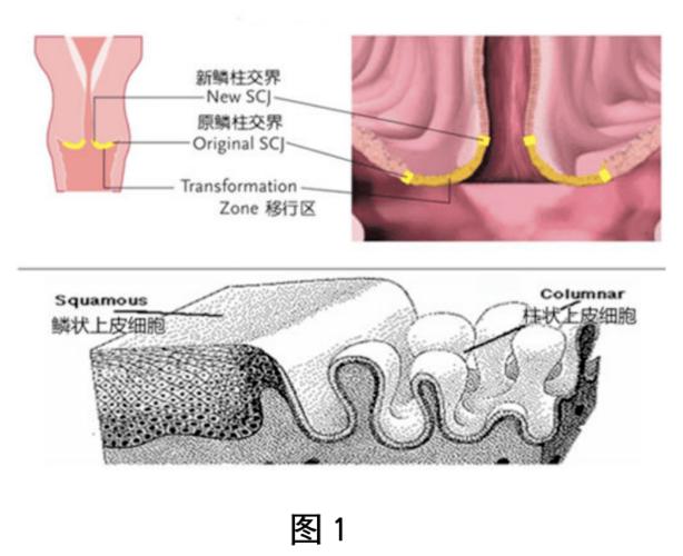 靠近阴道的部分主要是鳞状上皮细胞,靠近子宫的部分为柱状上皮细胞