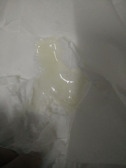 精液这样正不正常