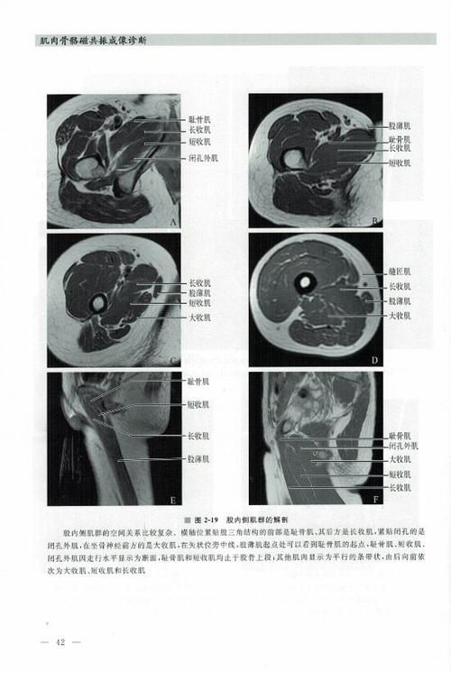 包邮 肌肉骨骼磁共振成像诊断 高元桂 人民军医 医学书籍 医药卫生