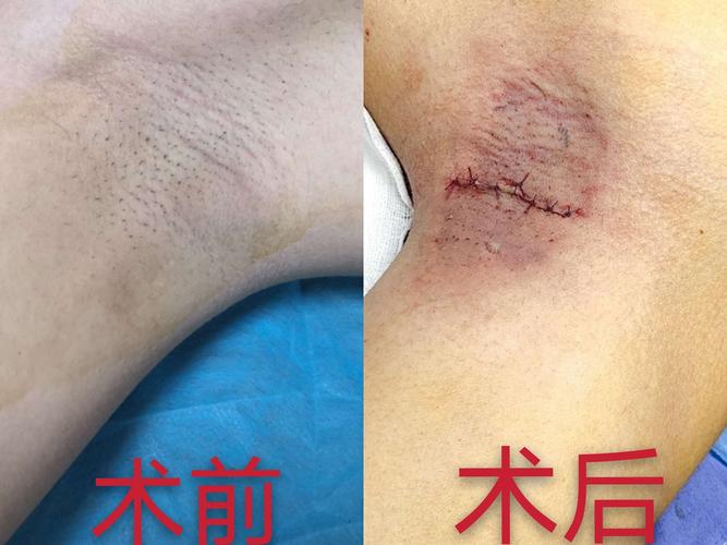 "狐臭"拜拜,清爽一夏