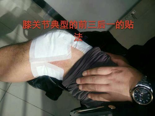 致本和膏药适用:青年低头族(电脑操作,长期低头工作者)中老年骨骼