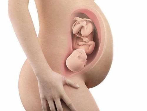 在怀孕最后一个月,去医院做产检时,大多数的孕妇都会问医生,胎儿是否