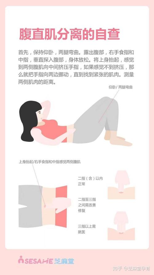 腹直肌分离的危害及自查