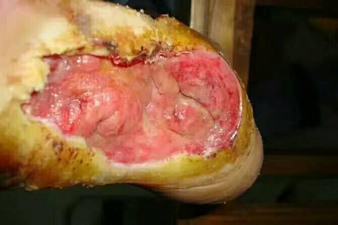难愈性皮肤溃疡,糖尿病足坏死一站式治疗.(医学专科资料胆小勿视)