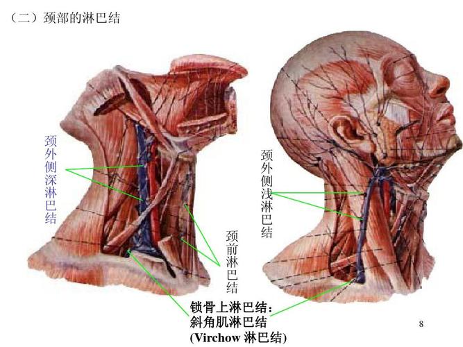 淋 巴 结 颈 前 淋 巴 结 锁骨上淋巴结: 斜角肌淋巴结 (virchow 淋巴