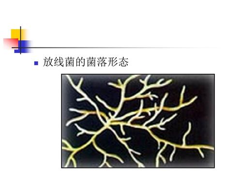 三,放线菌 1,什么是放线菌(actinomyces)?