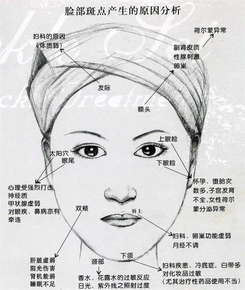 翌芙莱分享:面部长斑一定要重视!教你从色斑的位置看