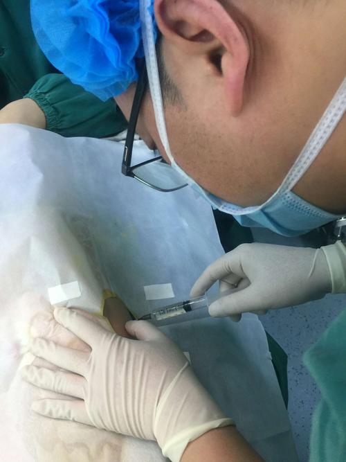 宿迁市儿童医院呼吸科完成闭式引流大量胸腔积液 支气管镜检查,灌洗