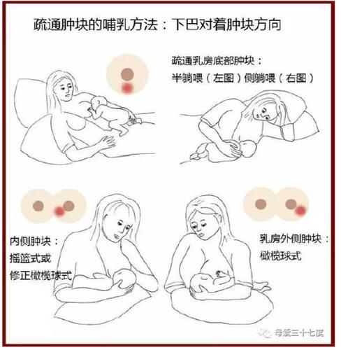 妈妈千万不要热敷,可以适当冷敷,奶量与血液循环相关,热敷会让泌乳量