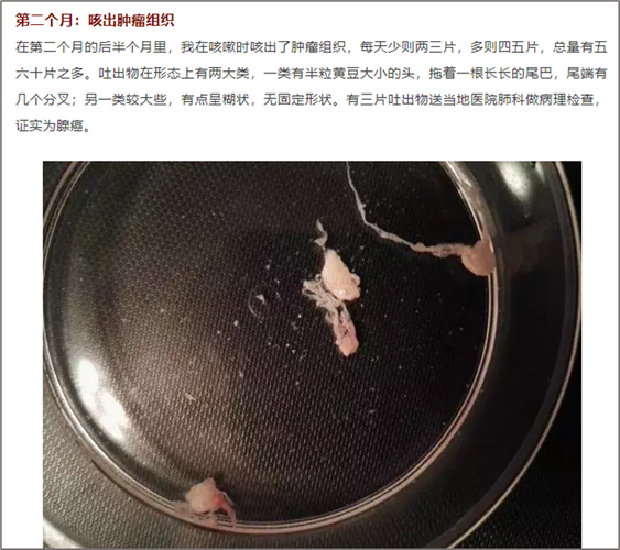 肺癌,配音,患者,nsclc,治疗,癌症,谭老,非小细胞肺癌,gavreto