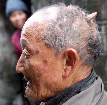 5个头上长角的人,中国占了3个