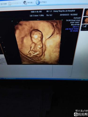 nt过啦,给你们欣赏一下照片吧!能看出男