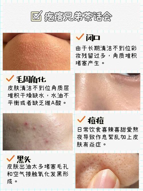 脸上密密麻麻的毛周角化别放弃!还有救!