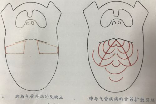 舌诊九区定位法