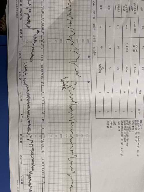 胎心监护图完全看不懂啊,会看的吗?
