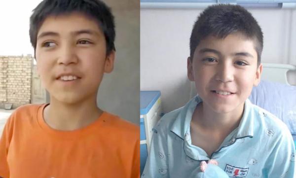 图说:拍组拉眼球震颤 斜视手术前后对比.受访者供图