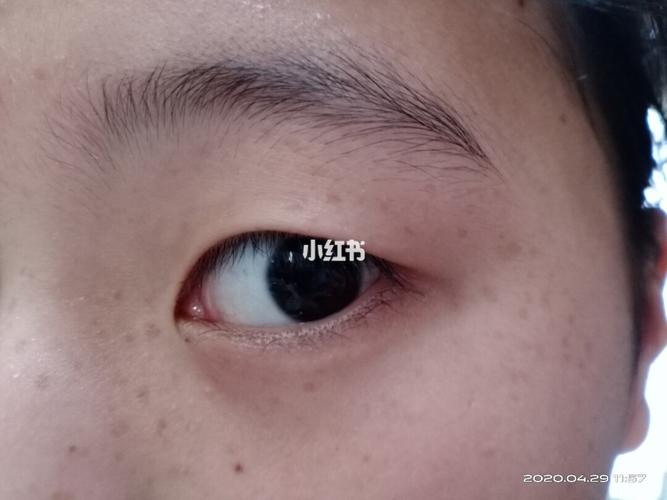 我一家三代都是这个眼睛,这叫什么眼,泪痕眼吗?我感觉